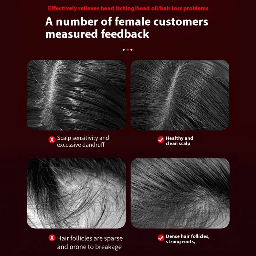 Scalp Revive Hair Massager